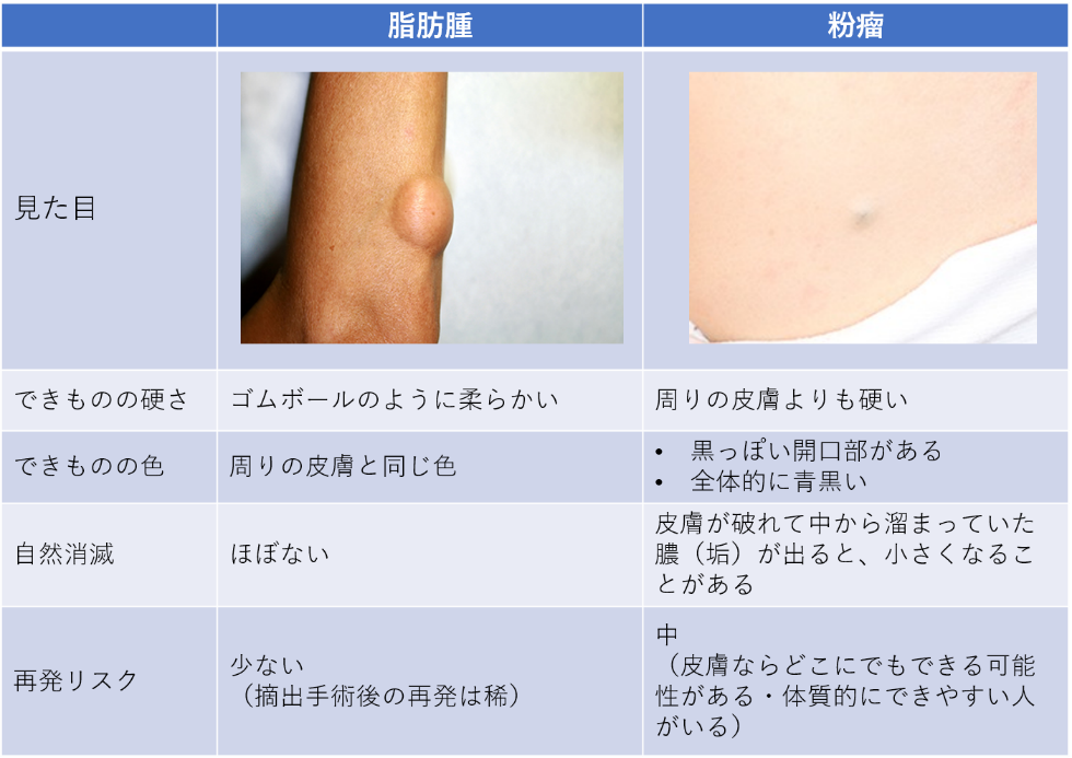 脂肪腫 きずときずあとのクリニック 豊洲院 東京都江東区の形成外科 美容外科