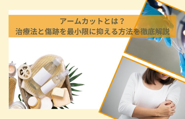アームカットとは？治療法と傷跡を最小限に抑える方法を徹底解説