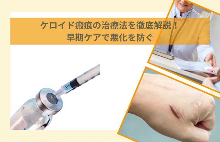 ケロイド瘢痕の治療法を徹底解説！早期ケアで悪化を防ぐ