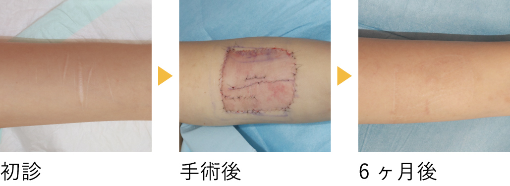 術後の経過