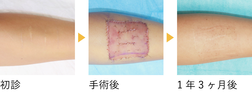 術後の経過