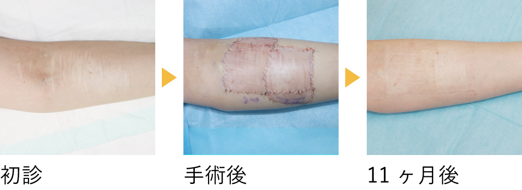 術後の経過