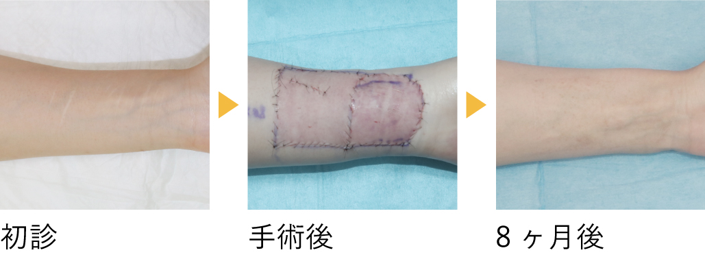 術後の経過