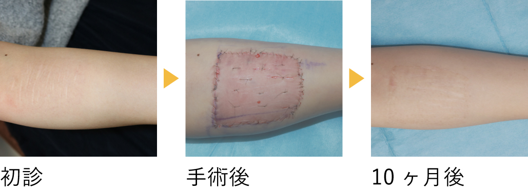 術後の経過