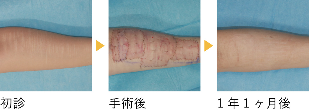 術後の経過