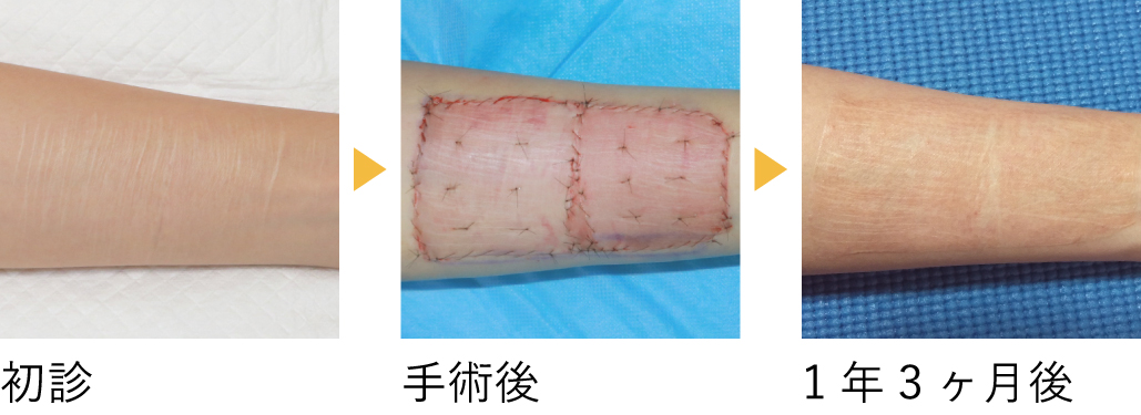 術後の経過